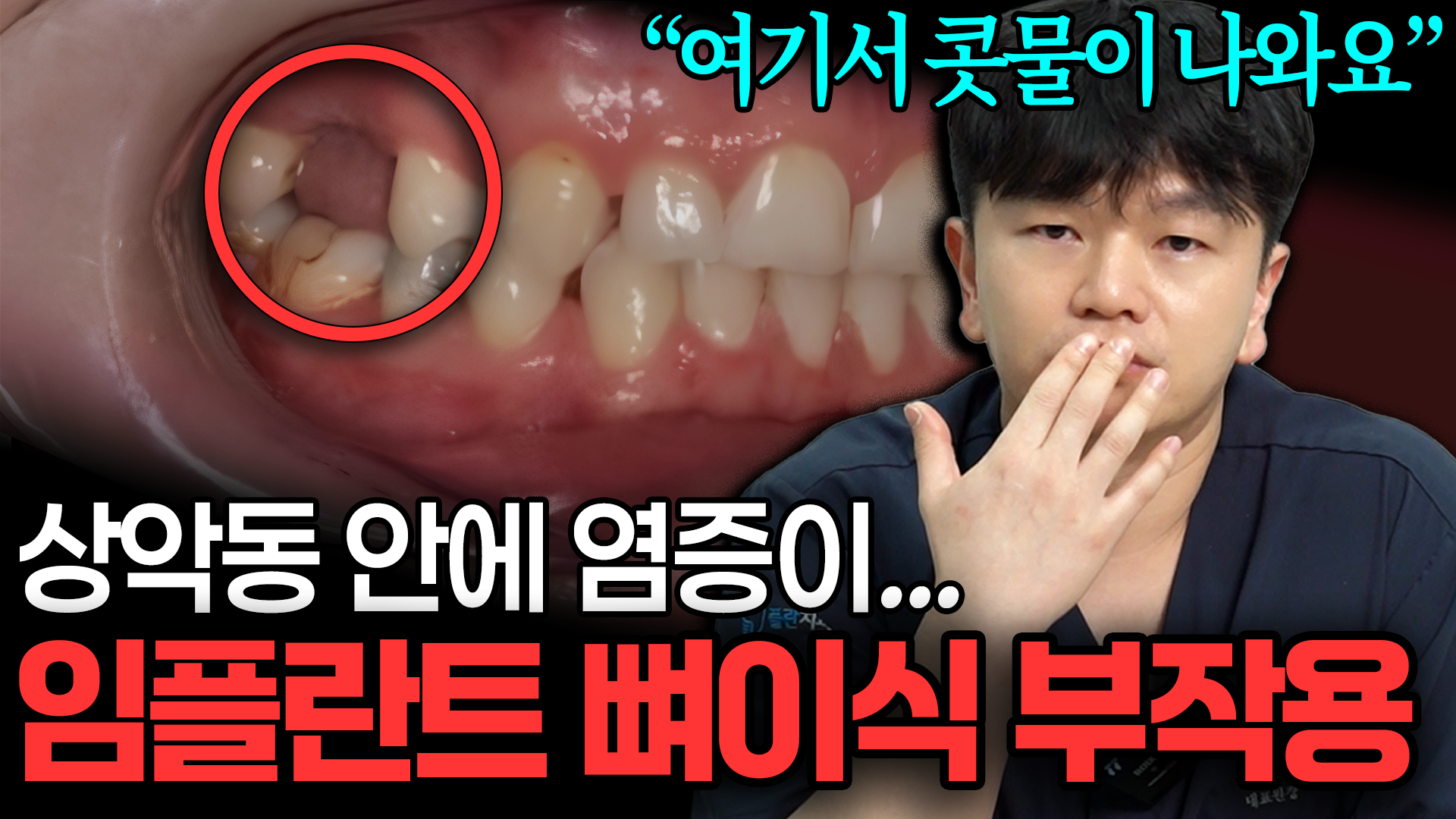 유튜브 썸네일 1